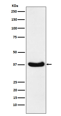 WB - AKR1C3 Antibody AP92124